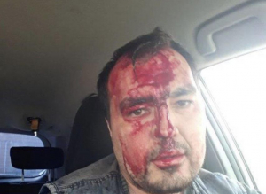 В Улан-Удэ журналист обвинил сына депутата Хурала в избиении