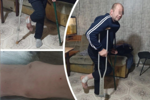 «Боль была адской, пальцы онемели»