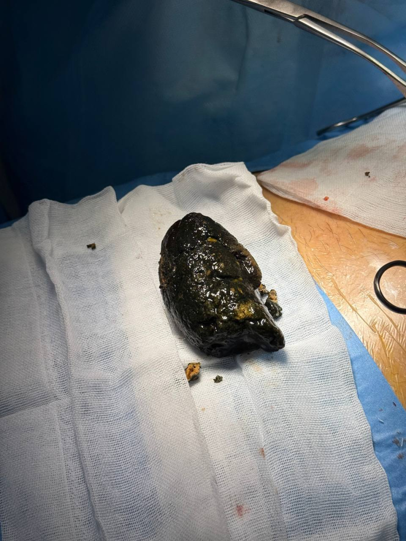 � ������ ����-��� ����� ������ � ������� ��-�� �����